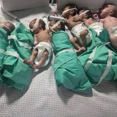 صورة للأطفال الخدج في مستشفى الشفاء بعد إخراجهم من الحاضنات حصار المستشفى ونفاذ الوقود خلال التصعيد الإسرائيلي ضد قطاع غزة خلال تشرين الأول لعام 2023